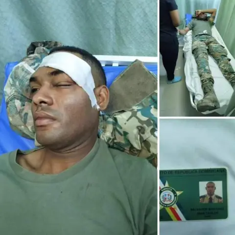 HAITÍANO LE PARTE LA FRENTE DE UNA PEDRADA A UN MIEMBRO DEL EJÉRCITO.