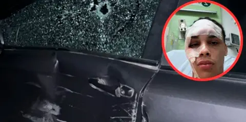 Policía arrestado tras disparar y agredir a joven en Gurabo, Santiago