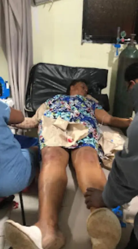 EN RESTAURACIÓN, HAITIANO ENCAPUCHADO AMORDAZA Y AGREDE SEÑORA PARA ROBARLE.