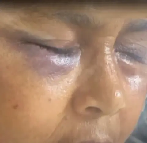 propinó varios garrotazos a su esposa