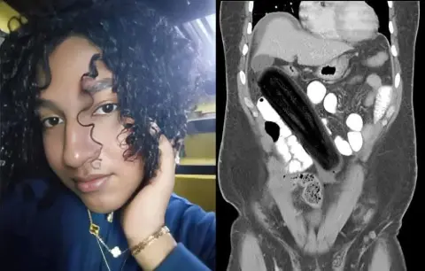 Le sacan un pepino del recto y su explicación dejó a todos en shock.