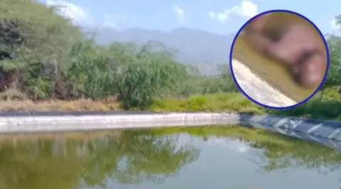 Autoridades investigan muerte de ciudadano haitiano en estanque de agua en zona agrícola