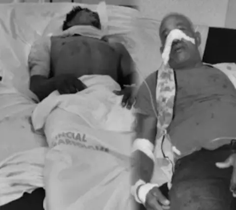 Dos motoconchistas resultan heridos tras sostener un enfrentamiento a machetazos