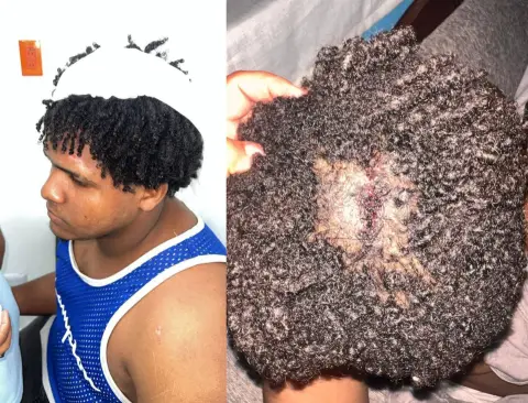 agreden joven por reclamar tiros de “mechitas”