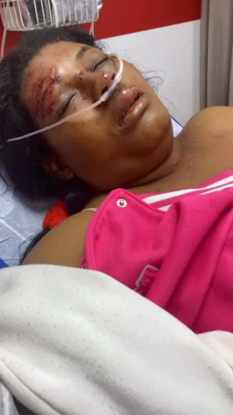 Mira quien fueron la mujeres de dajabón del accidente